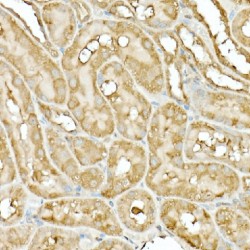 Heat Shock Protein 90kDa Alpha B1 (HSP90AB1) Antibody