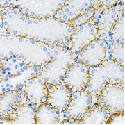 Immunohistochemistry of paraffin-embedded Mouse kidney using Tau Antibody (1/100 dilution, 40x lens).