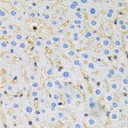 Microtubule-Associated Protein Tau (MAPT) Antibody