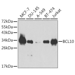 B-Cell Lymphoma/leukemia 10 (BCL10) Antibody
