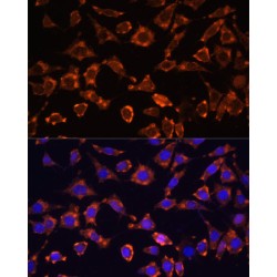 Interleukin 18 (IL18) Antibody
