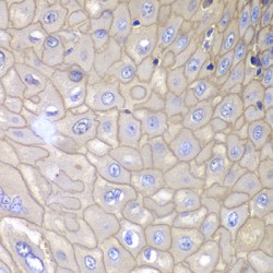 Annexin A1 (ANXA1) Antibody