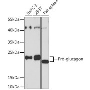 Western blot analysis of extracts of various cell lines using Pro-glucagon Antibody (1/3000 dilution).