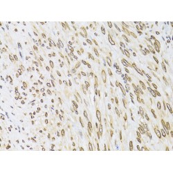 Emerin (EMD) Antibody