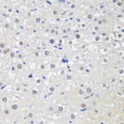 Immunohistochemistry of paraffin-embedded Rat liver using CTCF Antibody (1/200 dilution, 40x lens).