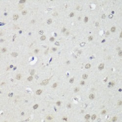 Transcriptional Repressor CTCF (CTCF) Antibody