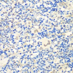Transcriptional Repressor CTCF (CTCF) Antibody
