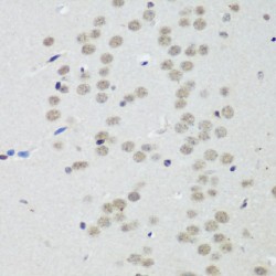 Transcriptional Repressor CTCF (CTCF) Antibody