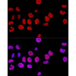 Transcriptional Repressor CTCF (CTCF) Antibody