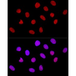 Transcriptional Repressor CTCF (CTCF) Antibody