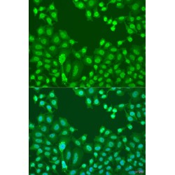 Transcriptional Repressor CTCF (CTCF) Antibody