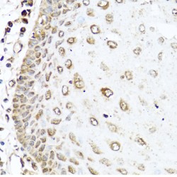 Ras-Related C3 Botulinum Toxin Substrate 2 (RAC2) Antibody
