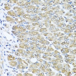 Ras-Related C3 Botulinum Toxin Substrate 2 (RAC2) Antibody