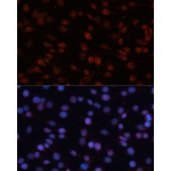 Transcription Factor 4 (TCF4) Antibody