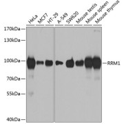 Western blot analysis of extracts of various cell lines using RRM1 Antibody (1/1000 dilution).