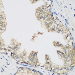 Ribonucleoside-Diphosphate Reductase Large Subunit (RRM1) Antibody