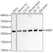 Western blot analysis of extracts of various cell lines using RAB7 Antibody (1/1000 dilution).