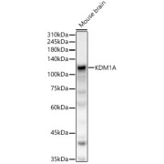 Western blot analysis of Mouse brain using KDM1A Antibody (1/500 dilution).