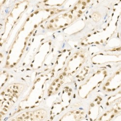 Lysine Demethylase 1A (KDM1A) Antibody