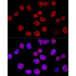 Lysine Demethylase 1A (KDM1A) Antibody
