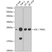 abx001084