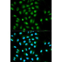 PYD And CARD Domain Containing (PYCARD) Antibody