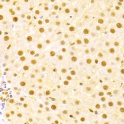 Cell Division Cycle 25A (CDC25A) Antibody