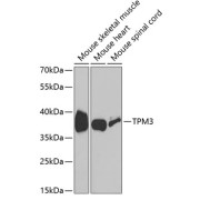 Western blot analysis of extracts of various cell lines using TPM3 Antibody (1/1000 dilution).