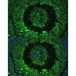 Defensin Beta 121 (DEFB121) Antibody