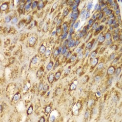 UDP-Glucose 6-Dehydrogenase (UGDH) Antibody