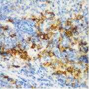 Immunohistochemistry of paraffin-embedded Rat spleen using CD3D Antibody (1/200 dilution, 40x lens).
