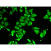 Immunofluorescence analysis of HeLa cells using Ataxin 3 Antibody