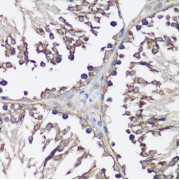 Immunohistochemistry of paraffin-embedded Rat testis using VAMP2 Antibody (1/100 dilution, 40x lens).