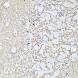 Vesicle-Associated Membrane Protein 2 (VAMP2) Antibody