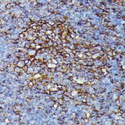 HLA class I histocompatibility antigen, B alpha chain (HLA-B) Antibody