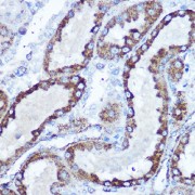 Immunohistochemistry of paraffin-embedded rat kidney using SOD2 Antibody (1/100 dilution, 40x lens). Microwave antigen retrieval was performed in 10 mM Tris/EDTA buffer pH 9.0 before commencing with IHC staining protocol.