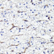 Immunohistochemistry of paraffin-embedded Human liver using CD44 Antibody (1/100 dilution, 40x lens).