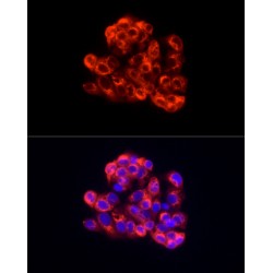 Albumin (ALB) Antibody