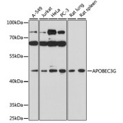 Western blot analysis of extracts of various cell lines using APOBEC3G Antibody (1/1000 dilution).