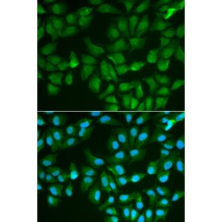 Lectin-Galactoside Binding Soluble 3 (LGALS3) Antibody