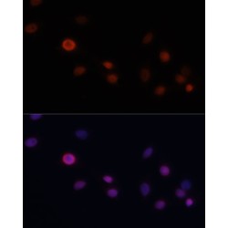 Cyclin Dependent Kinase Inhibitor 1A (CDKN1A) Antibody