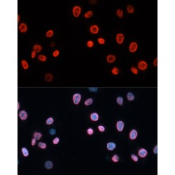 Cyclin Dependent Kinase Inhibitor 1A (CDKN1A) Antibody