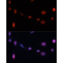 Cyclin Dependent Kinase Inhibitor 1A (CDKN1A) Antibody