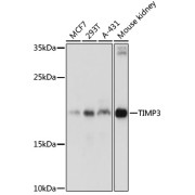 Western blot analysis of extracts of various cell lines using TIMP3 Antibody (1/1000 dilution).