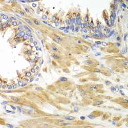 Protein Interacting With Protein Kinase C Alpha 1 (PICK1) Antibody