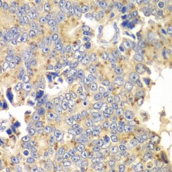 Protein Interacting With Protein Kinase C Alpha 1 (PICK1) Antibody