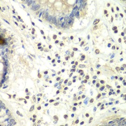 Protein Arginine N-Methyltransferase 5 (PRMT5) Antibody