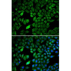 Protein Arginine N-Methyltransferase 5 (PRMT5) Antibody
