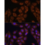 Immunofluorescence analysis of U-2 OS cells using UPF1 Antibody (1/100 dilution). Blue: DAPI for nuclear staining.