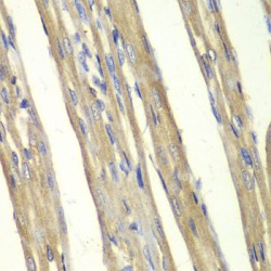 Caspase 7 (CASP7) Antibody